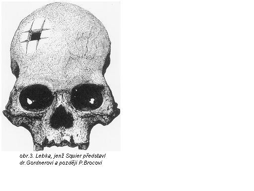 Slavn trepanovan lebka